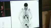 Abteilungsvideo Nuklearmedizin und Endokrinologie