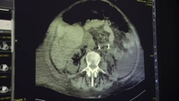 Abteilungsvideo Radiologie