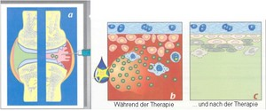 RNO waehrend der Therapie und nach der Therapie